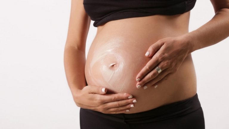 ස්ට්රෙච් මාක්ස් ගැන මොනවද දන්නේ